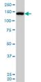 Cullin Associated And Neddylation Dissociated 1 antibody, H00055832-M01, Novus Biologicals, Western Blot image 