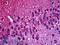 Tubulin Beta 3 Class III antibody, LS-B5225, Lifespan Biosciences, Immunohistochemistry paraffin image 