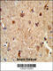 Carboxylesterase 5A antibody, 63-811, ProSci, Immunohistochemistry paraffin image 