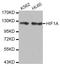 HIF1-alpha antibody, STJ28187, St John