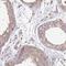 WD Repeat Domain 64 antibody, HPA046186, Atlas Antibodies, Immunohistochemistry paraffin image 