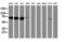 N-Myristoyltransferase 2 antibody, M07621-1, Boster Biological Technology, Western Blot image 