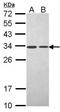 Proteasome Activator Subunit 3 antibody, orb73804, Biorbyt, Western Blot image 
