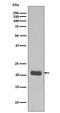 HRAS antibody, M00114, Boster Biological Technology, Western Blot image 