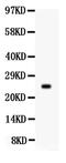 Prolactin antibody, PB9361, Boster Biological Technology, Western Blot image 