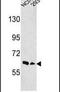 EPH Receptor A3 antibody, PA5-14576, Invitrogen Antibodies, Western Blot image 