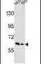 EPH Receptor A3 antibody, PA5-14576, Invitrogen Antibodies, Western Blot image 