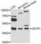 Somatostatin Receptor 1 antibody, STJ113261, St John