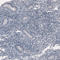 Ornithine Carbamoyltransferase antibody, AMAb91265, Atlas Antibodies, Immunohistochemistry frozen image 