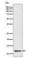 Dynein Light Chain Tctex-Type 1 antibody, M05556, Boster Biological Technology, Western Blot image 