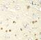 Hypoxia Inducible Factor 1 Subunit Alpha Inhibitor antibody, FNab03860, FineTest, Immunohistochemistry frozen image 