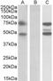 Asparagine Synthetase Domain Containing 1 antibody, TA311483, Origene, Western Blot image 