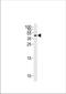 Serpin Family B Member 5 antibody, TA324471, Origene, Western Blot image 