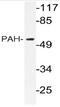 Phenylalanine Hydroxylase antibody, AP20792PU-N, Origene, Western Blot image 