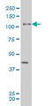 EPH Receptor B3 antibody, LS-C133177, Lifespan Biosciences, Western Blot image 