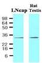 STEAP Family Member 1 antibody, GTX53786, GeneTex, Western Blot image 