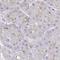 Transmembrane Protein 198 antibody, HPA056598, Atlas Antibodies, Immunohistochemistry paraffin image 