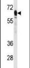 Phosphoenolpyruvate Carboxykinase 2, Mitochondrial antibody, PA5-15366, Invitrogen Antibodies, Western Blot image 