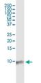 Barrier To Autointegration Factor 1 antibody, H00008815-M07, Novus Biologicals, Western Blot image 