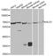 ALG1 Chitobiosyldiphosphodolichol Beta-Mannosyltransferase antibody, A7818, ABclonal Technology, Western Blot image 