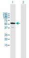 TBC1 Domain Family Member 22B antibody, H00055633-B01P, Novus Biologicals, Western Blot image 