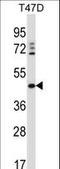 Delta 4-Desaturase, Sphingolipid 1 antibody, LS-C167352, Lifespan Biosciences, Western Blot image 