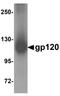HIV gp120 antibody, NBP1-76371, Novus Biologicals, Western Blot image 