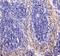 RAB27A, Member RAS Oncogene Family antibody, A01608-1, Boster Biological Technology, Immunohistochemistry paraffin image 