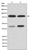 Protein Kinase C Beta antibody, M01940-2, Boster Biological Technology, Western Blot image 