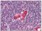 T Cell Leukemia Homeobox 1 antibody, AP08471PU-N, Origene, Immunohistochemistry paraffin image 