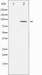 Protein Kinase C Alpha antibody, TA327797, Origene, Western Blot image 