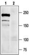 Sodium Voltage-Gated Channel Alpha Subunit 9 antibody, PA5-77727, Invitrogen Antibodies, Western Blot image 