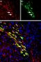 Solute Carrier Family 18 Member A2 antibody, PA5-77496, Invitrogen Antibodies, Immunohistochemistry paraffin image 