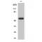 Keratin 8 antibody, LS-C380687, Lifespan Biosciences, Western Blot image 