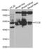 Propionyl-CoA Carboxylase Subunit Beta antibody, abx004148, Abbexa, Western Blot image 