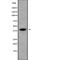 KH RNA Binding Domain Containing, Signal Transduction Associated 3 antibody, abx218434, Abbexa, Western Blot image 