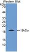 Thrombomodulin antibody, LS-C297804, Lifespan Biosciences, Western Blot image 