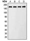 TBC1 Domain Family Member 4 antibody, MBS820276, MyBioSource, Western Blot image 