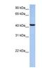 UDP-GlcNAc:BetaGal Beta-1,3-N-Acetylglucosaminyltransferase 7 antibody, NBP1-62633, Novus Biologicals, Western Blot image 