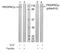 Protein Kinase D1 antibody, GTX38601, GeneTex, Western Blot image 