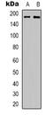 Erb-B2 Receptor Tyrosine Kinase 3 antibody, abx133613, Abbexa, Western Blot image 