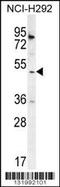 SH2 Domain Containing 4A antibody, 56-202, ProSci, Western Blot image 