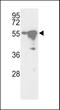 Serine/Threonine Kinase 25 antibody, LS-B10544, Lifespan Biosciences, Western Blot image 