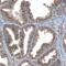 TBC1 Domain Family Member 23 antibody, PA5-58274, Invitrogen Antibodies, Immunohistochemistry frozen image 