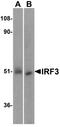 Interferon Regulatory Factor 3 antibody, A00165-1, Boster Biological Technology, Western Blot image 