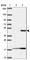 Acid Phosphatase, Prostate antibody, HPA063916, Atlas Antibodies, Western Blot image 