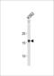 Hmgi antibody, PA5-26115, Invitrogen Antibodies, Western Blot image 