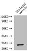 IL-6 antibody, A54025-100, Epigentek, Western Blot image 