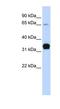 Troponin T1, Slow Skeletal Type antibody, NBP1-54820, Novus Biologicals, Western Blot image 