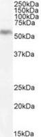 Diacylglycerol O-Acyltransferase 1 antibody, NB100-57086, Novus Biologicals, Western Blot image 